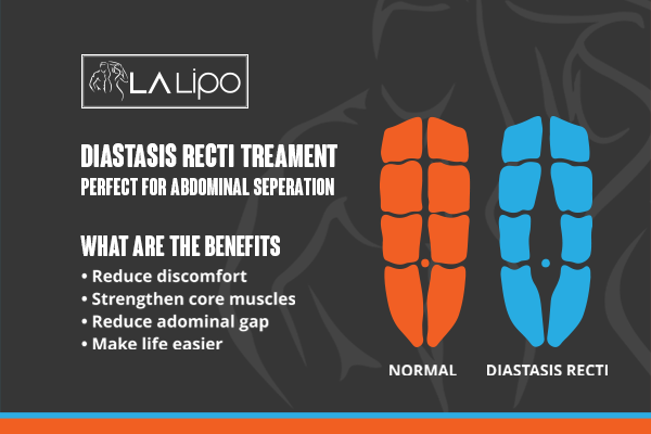 When to Be Concerned About Abdominal Muscle Changes Glossop
