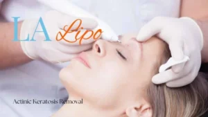 Woman receiving Actinic Keratosis Removal Treatment Glossop