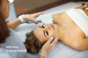 Woman having Hi-Fu to reduce wrinkles Glossop.