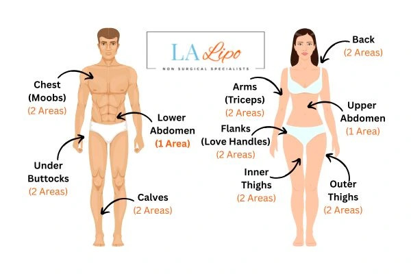 LA LIPO Cryolipolysis Areas Glossop