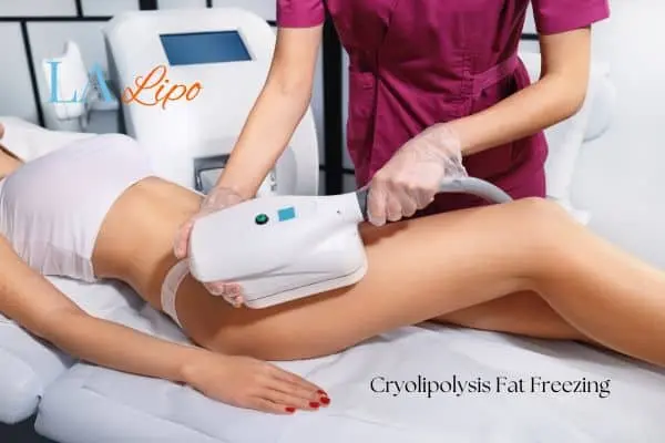 Woman receiving coolsculpting Glossop treatment on her thighs