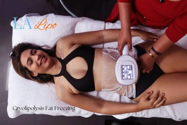 woman getting cryolipolysis Glossop