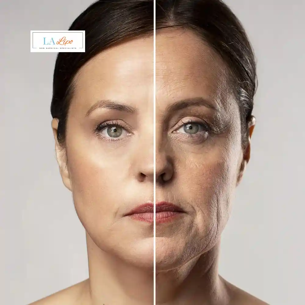 How Can You Tell If Non-Surgical Skin Tightening Is Right for You Glossop?