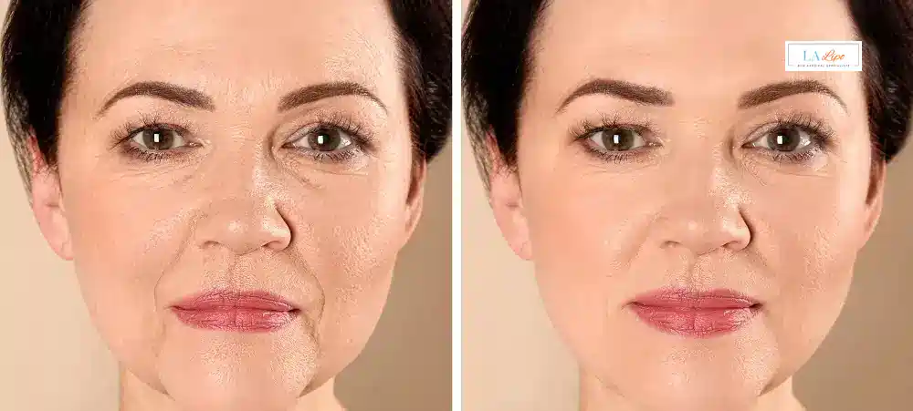 How Long Does It Take to See Results and How Long Do They Last Glossop?