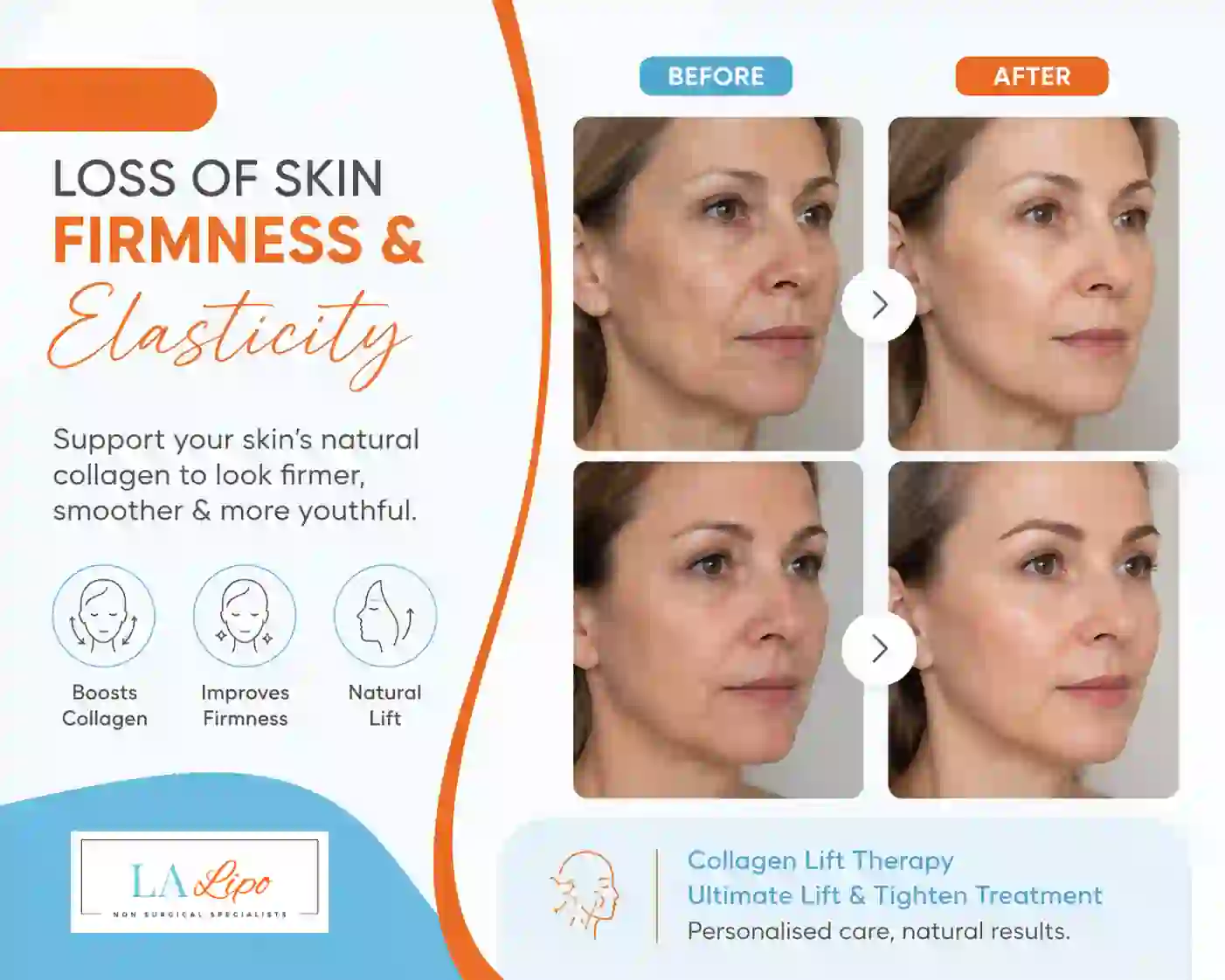 Sign #7: Loss of Skin Firmness and Elasticity Glossop